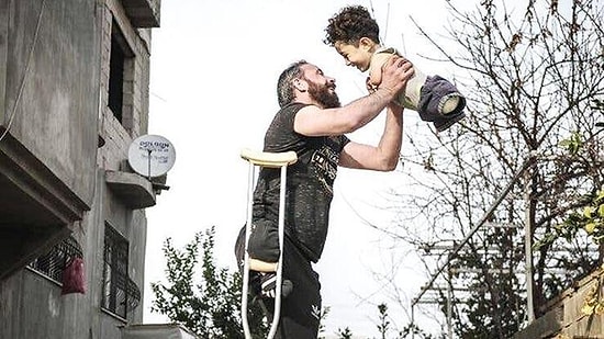 Bir Fotoğraf Hayatlarını Değiştirdi: Suriyeli Ampute Baba ve Engelli Oğlu Tedavi İçin İtalya'ya Gitti