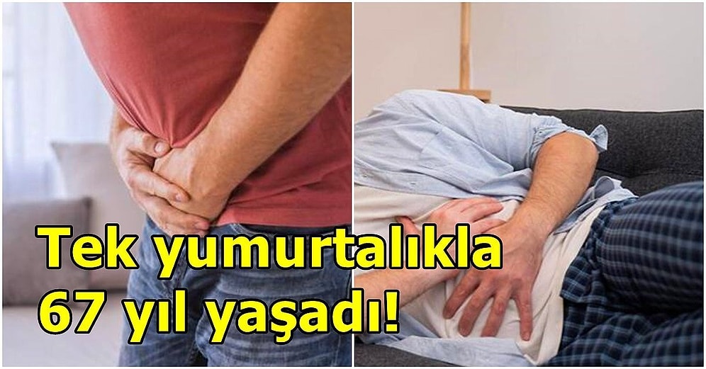 Bilimi Şoke Eden Olay! Kasık Fıtığı Şikayetiyle Hastaneye Giden Adamın Çift Cinsiyetli Olduğu Ortaya Çıktı