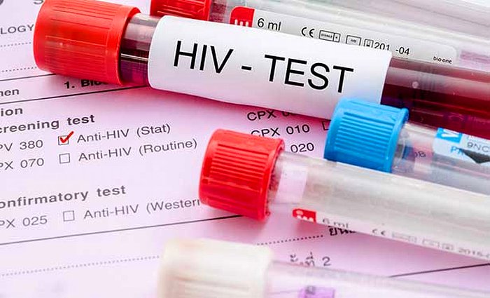 Dünyada Bir İlk: Kök Hücre Tedavisi Gören Kadın HIV'i Yenmeyi Başardı