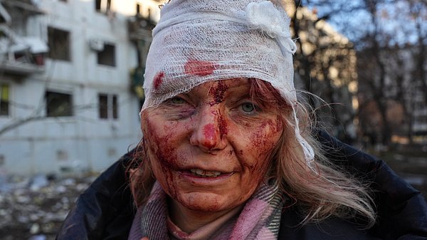 Onlardan bir tanesi de 58 yaşındaki Elena öğretmenin başından yaralandığı fotoğraf oldu.