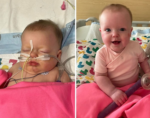 3. Эта девочка чуть не умерла из-за сильных болезней, но теперь она здорова и улыбается!