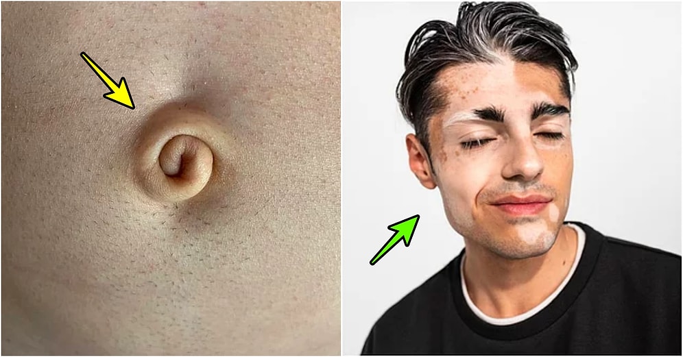 Özgünlüğün Kitabını Yazdıracak Kadar Benzersiz Özellikleriyle İnsanları Kendilerine Hayran Bırakan 15 Kişi