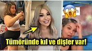 Kilo Veremediği İçin Gittiği Kontrolde Akla Hayale Gelmeyecek Bir Gerçekle Karşılaşan Kadının Hikayesi