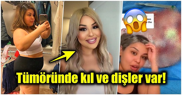 Kilo Veremediği İçin Gittiği Kontrolde Akla Hayale Gelmeyecek Bir Gerçekle Karşılaşan Kadının Hikayesi