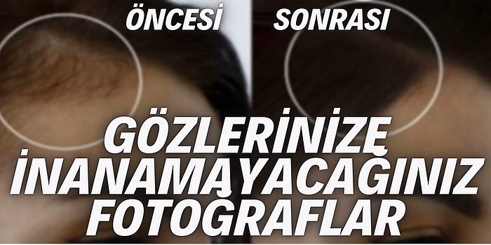 Öncesi ve Sonrası Hallerini Gördüğünüzde İnanamayacağınız 20 Dramatik Fotoğraf