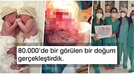 Amniyotik Keseleri Zarar Görmeden Dünyaya Gelen İkiz Bebekleri Görünce Epey Şaşıracağınız Kesin!