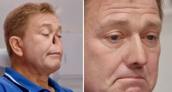 Protez Burun Takılan Adamın Artık Bir Buruna Sahip Olduğunu Görünce Gözyaşlarına Boğulduğu Eşsiz Anlar