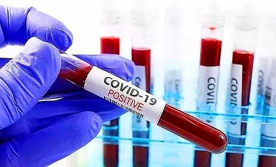 16 Nisan Cumartesi Koronavirüs Tablosu Açıklandı: Bugün Güncel Vaka Sayısı Kaç Oldu? Vaka ve Vefat Sayısı Kaç?