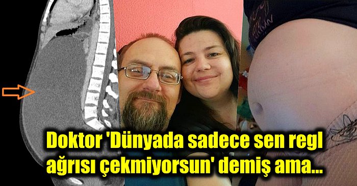 Doktorların Kilo Aldığını Söylemesinin Ardından Karnından Çıkan Şeyle Hayatının Şokunu Yaşayan Kadın