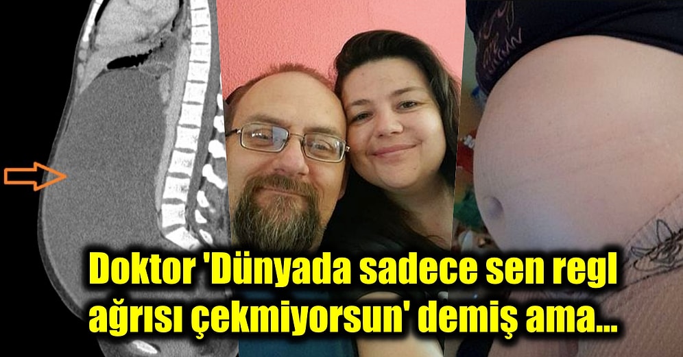 Doktorların Kilo Aldığını Söylemesinin Ardından Karnından Çıkan Şeyle Hayatının Şokunu Yaşayan Kadın