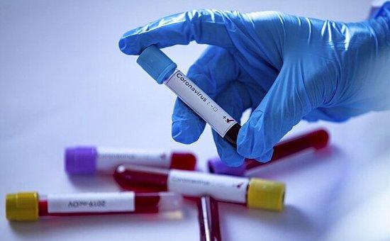 21 Nisan Güncel Koronavirüs Tablosu 2022: Bugün Vaka ve Vefat Sayısı Kaç Oldu? Vaka Sayısı Arttı mı Azaldı mı?