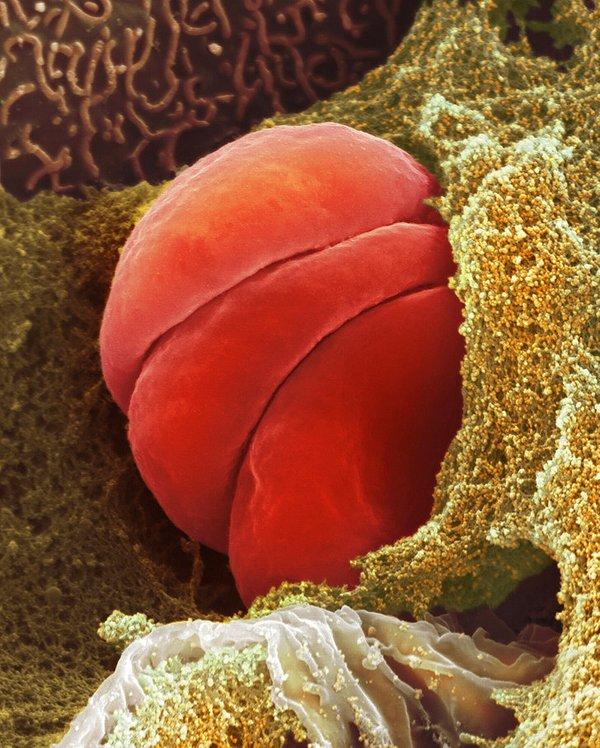 6. Kılcal damar içinde sıkışan kırmızı kan hücreleri: