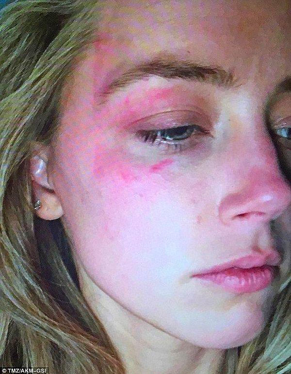 1. İlk olarak Amber Heard'ün fiziksel şiddet gördüğünü iddia etmesi ile başlayalım.