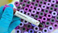30 Nisan Cumartesi Koronavirüs Tablosu: Güncel Vaka Sayısı Kaç? Vaka ve Vefat Sayısı Kaç Oldu?
