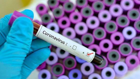30 Nisan Cumartesi Koronavirüs Tablosu: Güncel Vaka Sayısı Kaç? Vaka ve Vefat Sayısı Kaç Oldu?