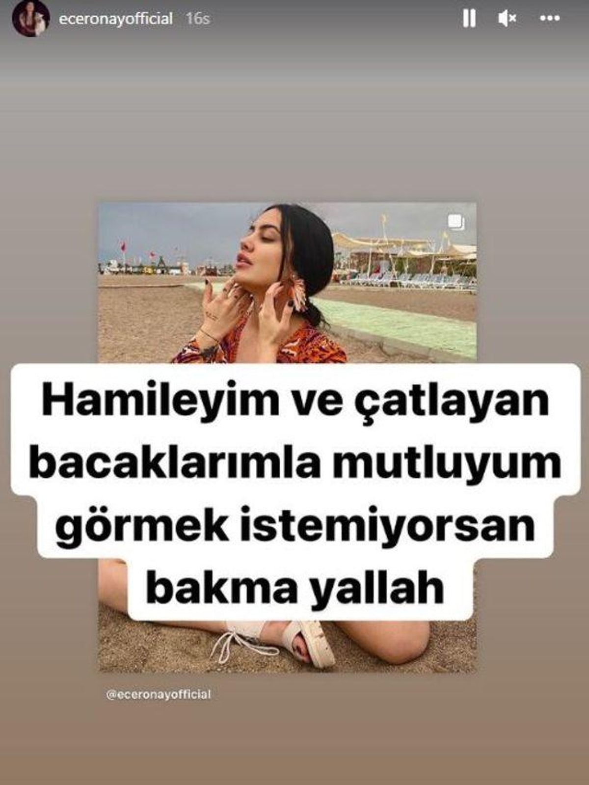 Ronay da "Hamileyim ve çatlayan bacaklarımla mutluyum görmek istemiyor...