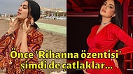 Ünlü Fenomen Ece Ronay Çatlaklarıyla İlgili Yorum Yapan Takipçilerine Tepki Gösterdi!