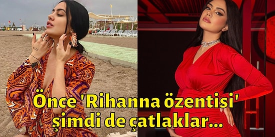 Ünlü Fenomen Ece Ronay Çatlaklarıyla İlgili Yorum Yapan Takipçilerine Tepki Gösterdi!
