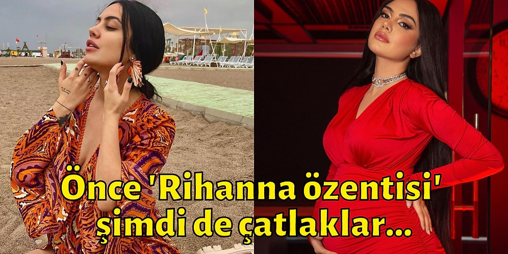 Ünlü Fenomen Ece Ronay Çatlaklarıyla İlgili Yorum Yapan Takipçilerine Tepki Gösterdi!