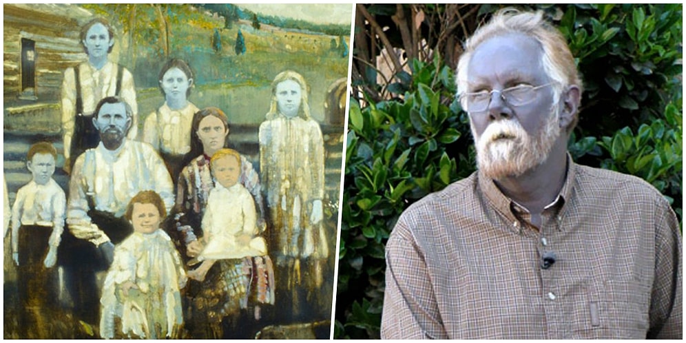 Mavi Ten Renkleri ile Avatar Filminden Fırlamış Gibi Gözüken Fugate Ailesini Görünce Şaşkına Döneceksiniz!