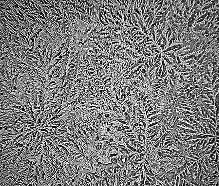 Слеза под микроскопом. Слеза под микроскопом. Слеза под микроскопом. Слеза под микроскопом. Слезы под микроскопом топография эмоций.