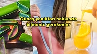 Cildinizde Kalıcı Lekeler Oluşabilir! Güneşin Altında Istakoz Gibi Yandıktan Sonra Yapmamanız Gerekenler