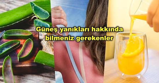 Cildinizde Kalıcı Lekeler Oluşabilir! Güneşin Altında Istakoz Gibi Yandıktan Sonra Yapmamanız Gerekenler