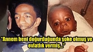 Çenesi Olmadığı İçin Konuşmakta, Yemek Yemekte ve Hatta Nefes Almakta Zorlanan Adamın Şaşırtıcı Hayat Hikayesi
