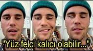 Dünyaca Ünlü Şarkıcı Justin Bieber, Nadir Görülen Bir Sendrom Nedeniyle Yüz Felci Geçirdiğini Açıkladı!
