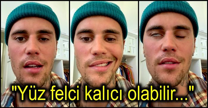 Dünyaca Ünlü Şarkıcı Justin Bieber, Nadir Görülen Bir Sendrom Nedeniyle Yüz Felci Geçirdiğini Açıkladı!