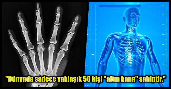 Sizi Eşsiz ve Küçük Bir Grubun Parçası Yapan Az Rastlanır Genetik Özellikler
