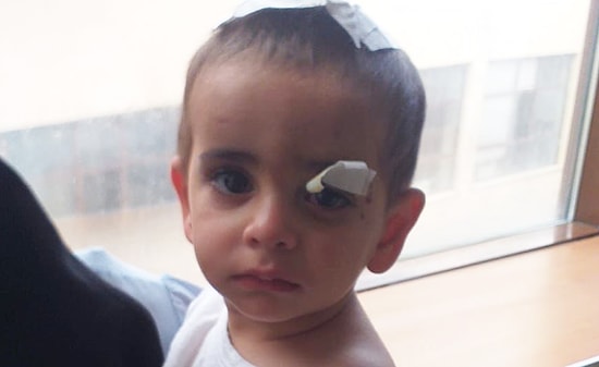 Başıboş Köpeklerin Saldırdığı 2 Yaşındaki Ali Asaf Yaşamını Yitirdi