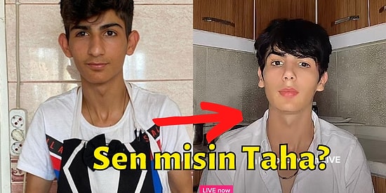 İşte Son Hali! Estetik Yaptıran TikTok Fenomeni Taha Duymaz'ın Yeni Görüntüsü Herkesi Şaşırttı