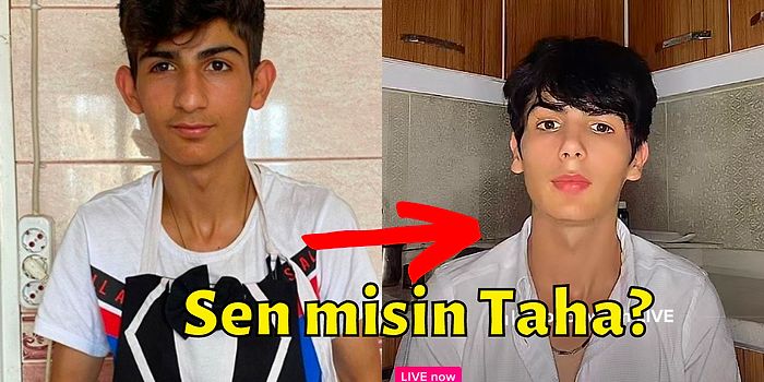 İşte Son Hali! Estetik Yaptıran TikTok Fenomeni Taha Duymaz'ın Yeni Görüntüsü Herkesi Şaşırttı