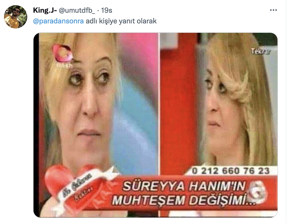 Estetik Öncesi ve Sonrası Fotoğrafı Paylaşılınca İrem Dericiden Cevap Gecikmedi! - Onedio