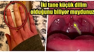 Daha Önce Kimsede Görmediğinizi İddia Ettiğimiz Birbirinden Şaşırtıcı Vücut Özelliklerine Sahip Olan 19 Kişi