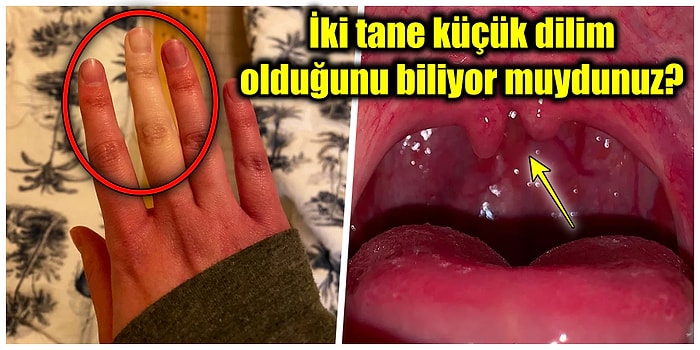 Daha Önce Kimsede Görmediğinizi İddia Ettiğimiz Birbirinden Şaşırtıcı Vücut Özelliklerine Sahip Olan 19 Kişi