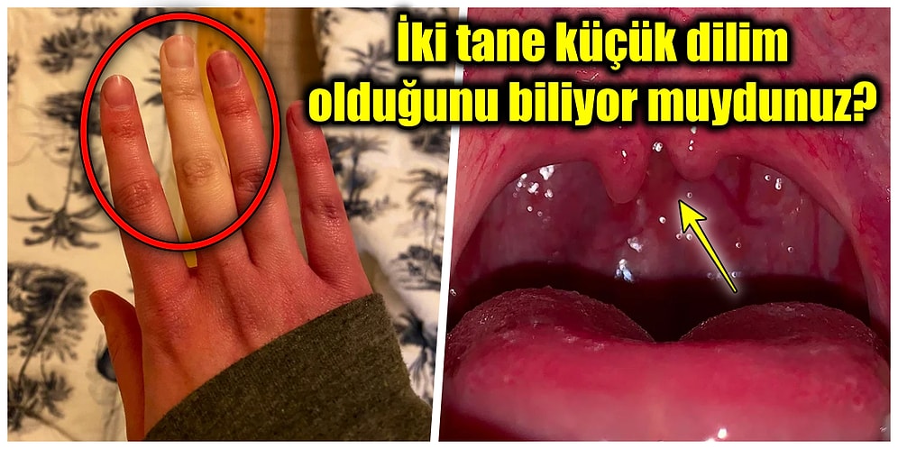 Daha Önce Kimsede Görmediğinizi İddia Ettiğimiz Birbirinden Şaşırtıcı Vücut Özelliklerine Sahip Olan 19 Kişi