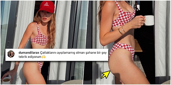 Dilan Deniz'in Ardından Fenomen Duygu Özaslan da Çatlaklarıyla Poz Vererek Herkesi Epey Şaşırttı!