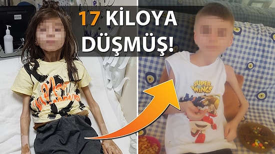 Çöp Evde Bulunan Çocuğun Sağlık Durumuna İlişkin Açıklama Geldi!