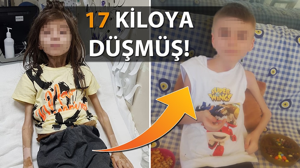 Çöp Evde Bulunan Çocuğun Sağlık Durumuna İlişkin Açıklama Geldi!