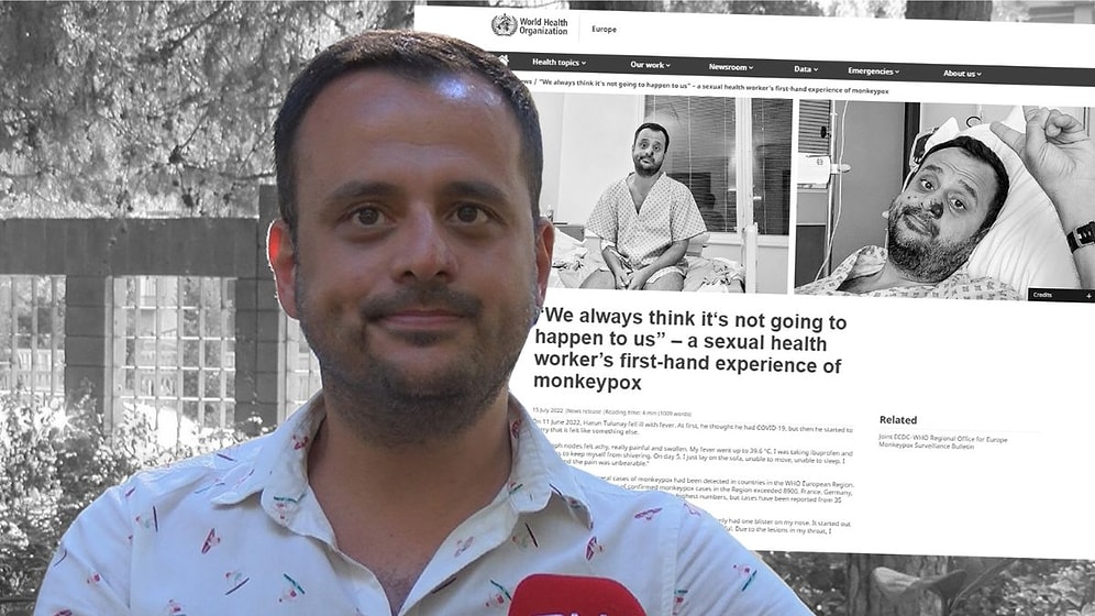 HIV, Covid-19 ve Maymun Çiçeğini Yendi, Damgalanmayı Yenemedi