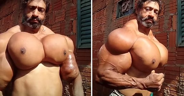 Несмотря на все предупреждения, Сегато, который продолжал вводить в мышцы синтол, масляный ингредиент, умер в результате сердечного приступа...