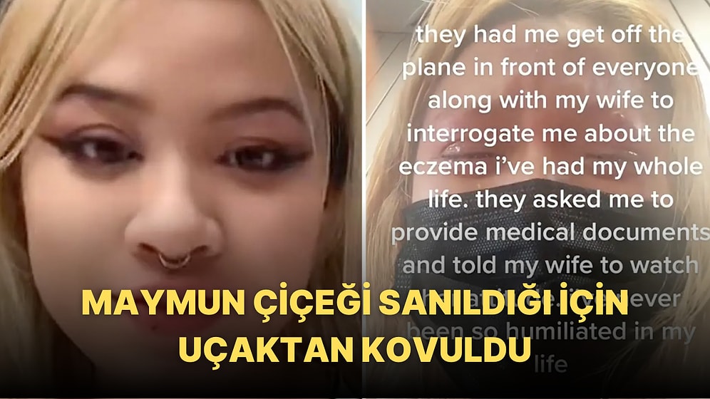 Maymun Çiçeği Olduğundan Şüphelenin Egzamalı Kadını Uçaktan İndirdiler