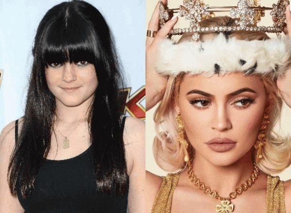 Тест: какую пластическую операцию вы бы сделали, если бы были богаты?