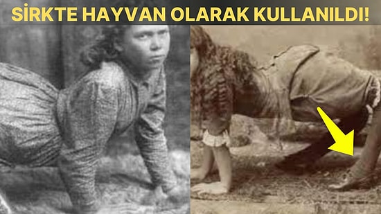 Ayakları Ters Olduğu İçin ‘Deve Kız’ Olarak da Bilinen Ella Harper’ın Korku Filmlerine Taş Çıkartan Hikayesi