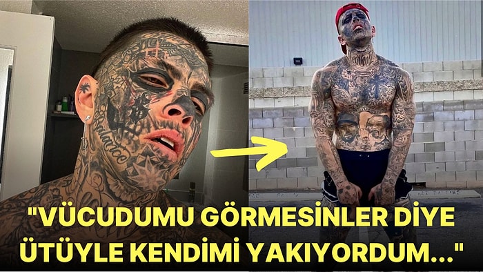 Kemoterapinin Sebep Olduğu Sivilceleri Kapatmak İçin Vücudunu Dövmeyle Kaplatan Adamın Enteresan Hikayesi