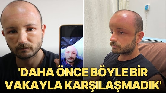 İki Gün Plaja Gitti, Hayatı Kabusa Döndü!