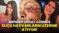 Sevda Demirel, Köpek Saldırısına Uğrayan Tuğba Altıntop'un Hemcinsinden Şiddet Gördüğünü İddia Etti!