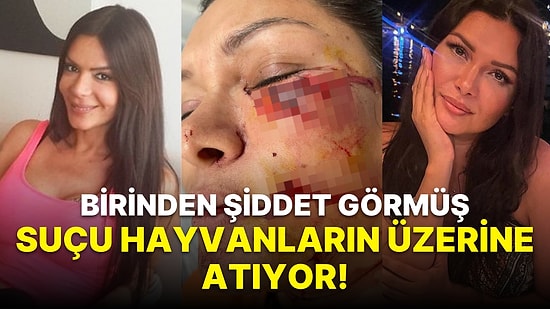 Sevda Demirel, Köpek Saldırısına Uğrayan Tuğba Altıntop'un Hemcinsinden Şiddet Gördüğünü İddia Etti!